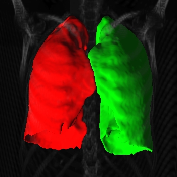 Lung segmentation VR
