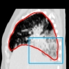lung segmentation
