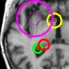 Brain T1 MRI keypoints
