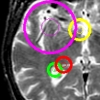 Brain T2 MRI keypoints