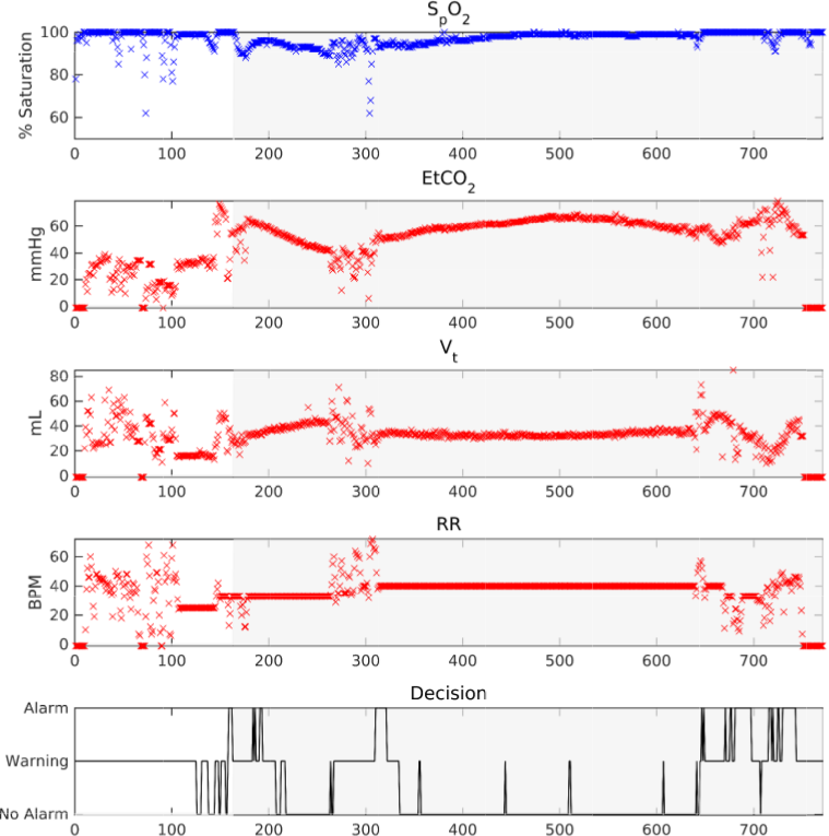 Prediction of Critical Pulmonary Shunts